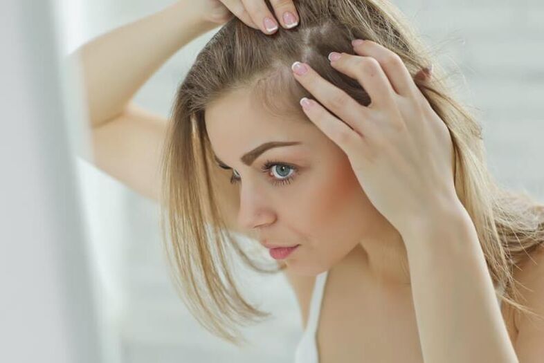 Tüdruk uurib alopeetsia koldeid