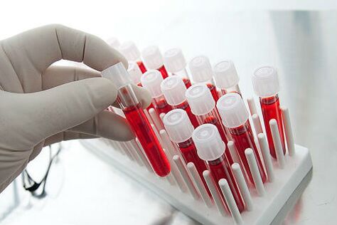 Vereanalüüs alopeetsia individuaalse ravi määramiseks